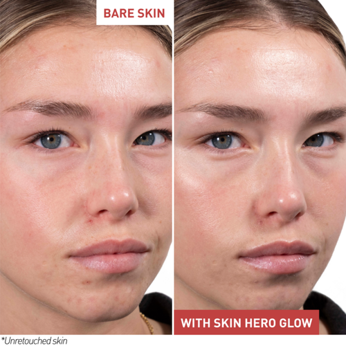 view 6/7 of Skin Hero Glow, , large